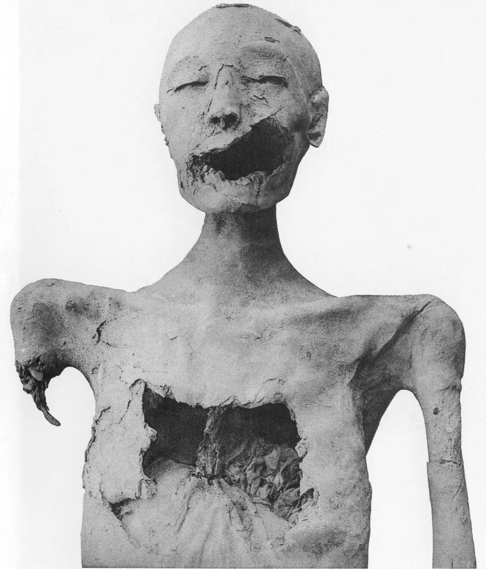 Archival 1912 photograph of the mummy of the Younger Lady, front view, showing the severe wound to the left side of her face and mouth.